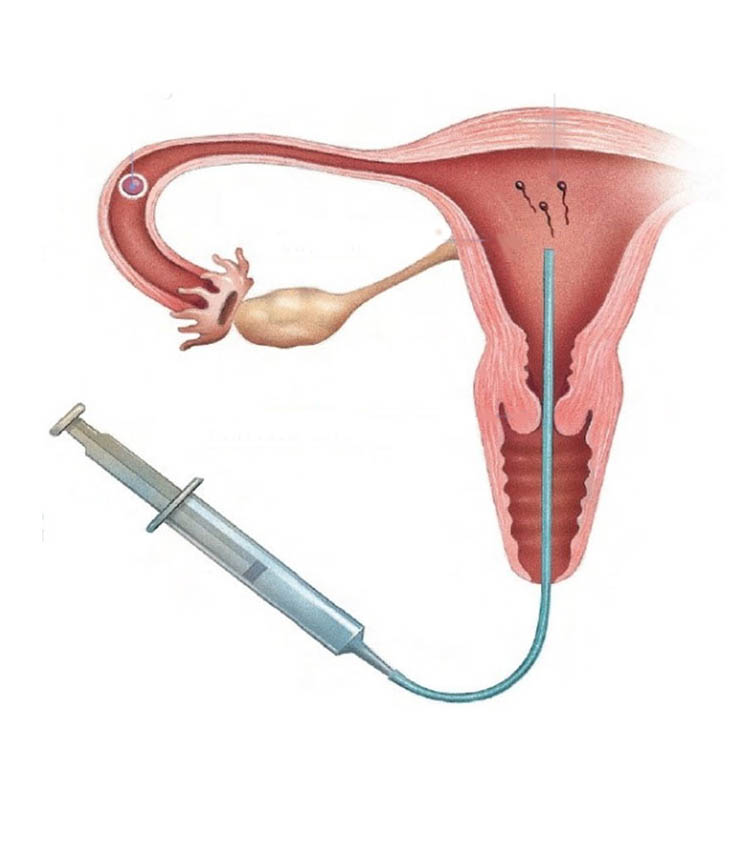 inseminación